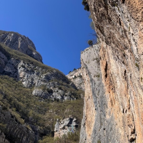 Alla ghigliottina non ho perso la testa, ma le dita fanno ancora&nbsp;male